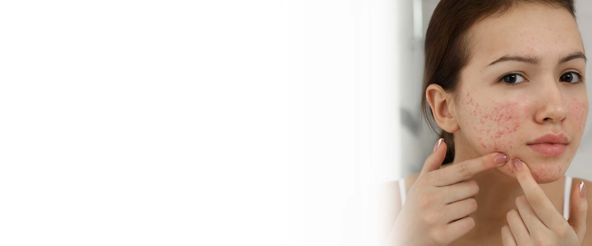 LED light therapy at Perfect U Clinic Bangalore