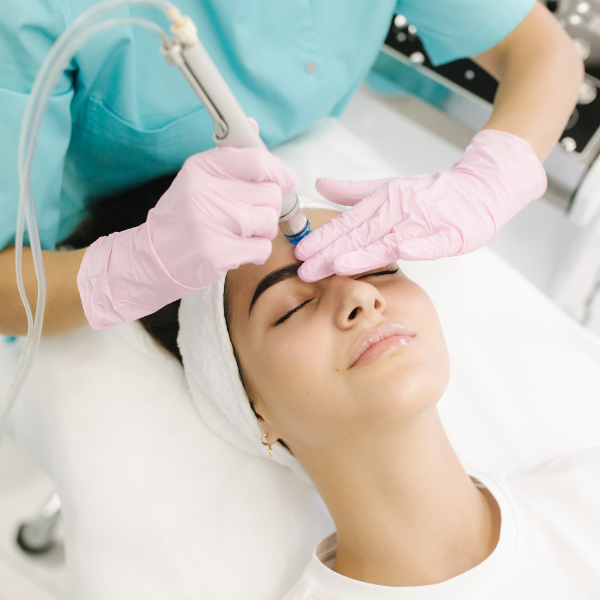Chemical Peels