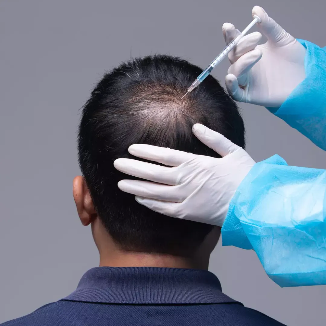 hair-mesotherapy