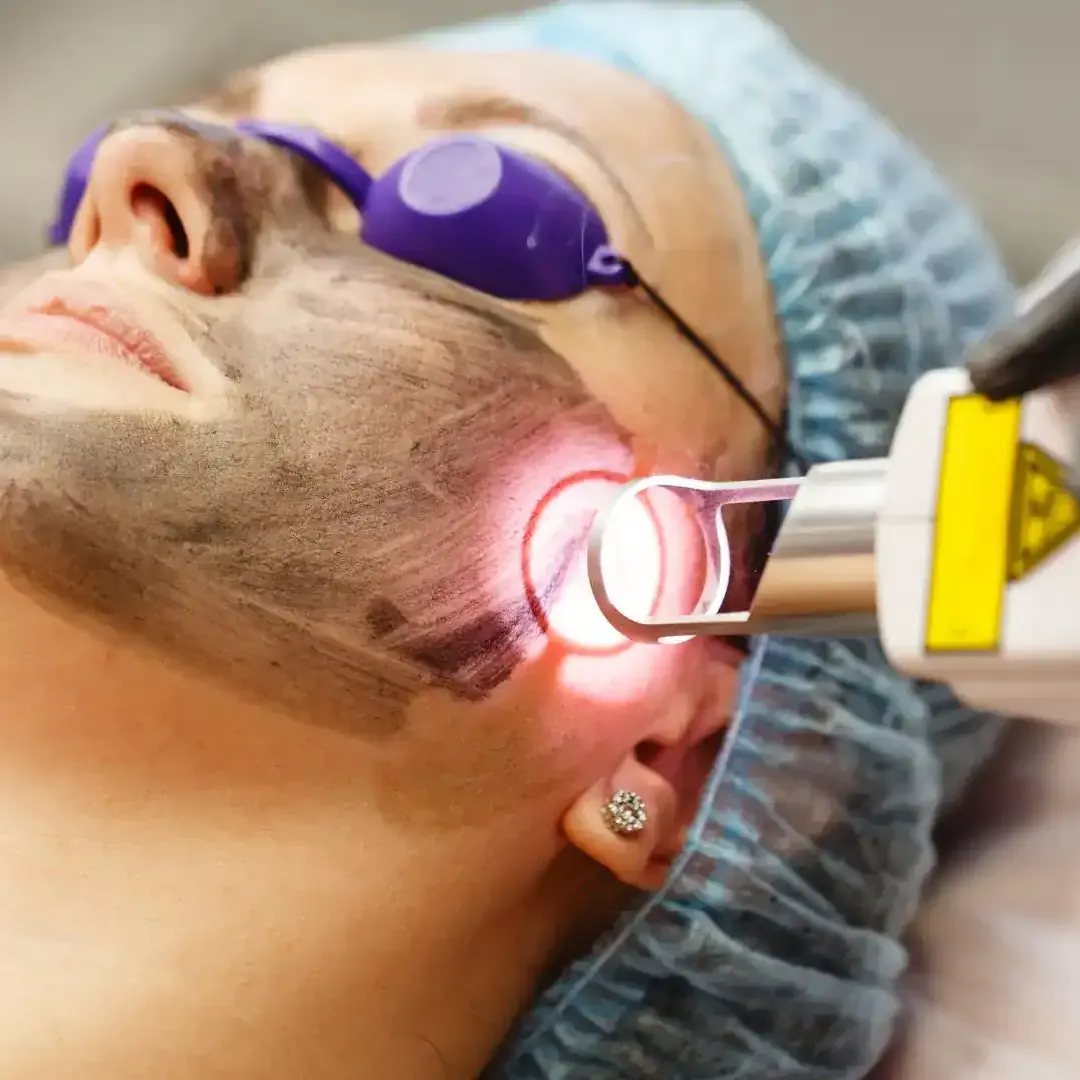 laser-skin-treatment