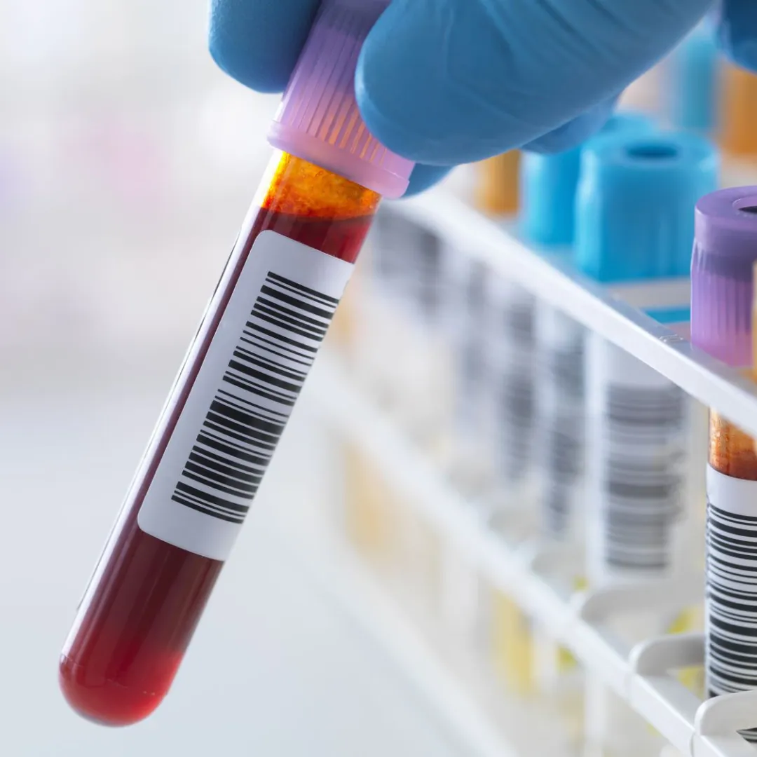 metabolic-and-hormonal